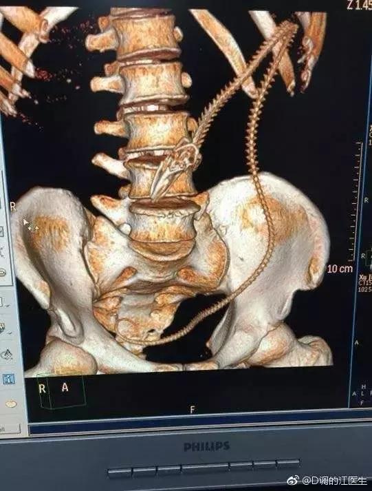 脑洞无限开新鲜的鱼,脑洞大开漏网之鱼