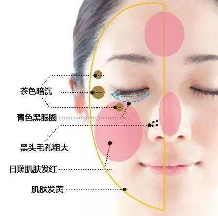 青少年脸上肤色不均匀是什么原因,我脸上肤色不均匀用什么可以改善
