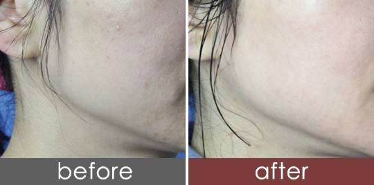 处女脸、果汁脸，你的老公鹿晗林更新们到底心水哪一款？