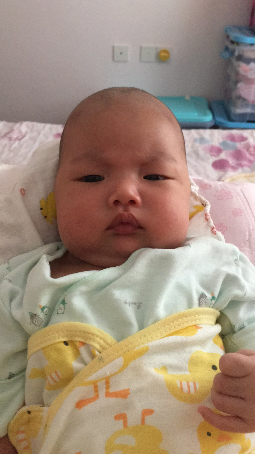 头皮结痂反复抠掉了头秃了,头皮结痂又抠掉又结痂图片