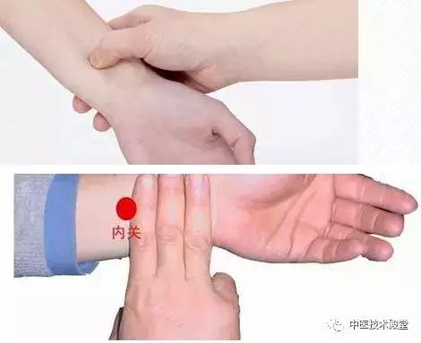 头痛用手揪一揪,头痛揪痧揪眉心就不痛是什么原因