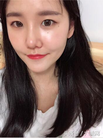 隆鼻后如何克服焦虑,隆鼻后前三天状态