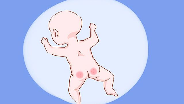 宝宝有这几种现象，说明早就上火了