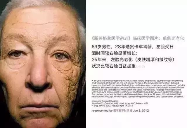 男人也要防晒吗,男士应该防晒吗