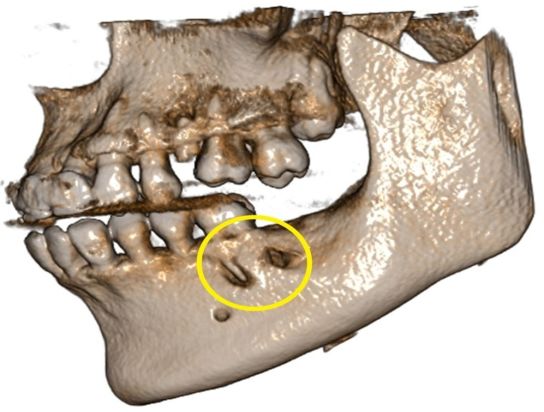 战痘多年才知道的真相,战痘多年不见效果