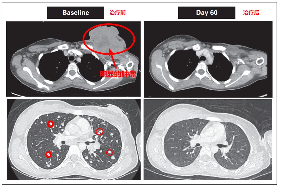 神奇制药抗癌专利,神奇制药抗癌药取得突破