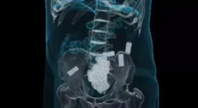 可笑又可怕，为了运毒，他们连小丁丁都不放过