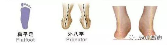 瑜伽纠正脚的正位,瑜伽改善走路外八字脚