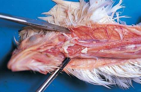 鸡支气管栓塞的最佳治疗,鸡支气管栓塞什么原因