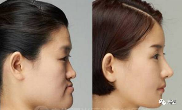 迪丽热巴被p图事件回应,迪丽热巴被p图的视频