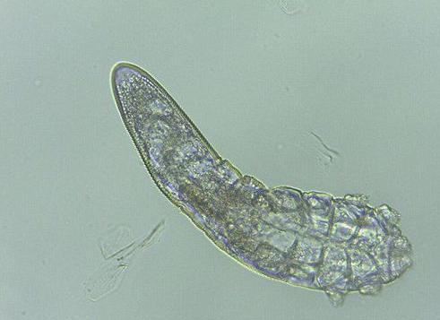 头上的螨虫用什么药杀它,头上螨虫怎么消灭才能彻底除根