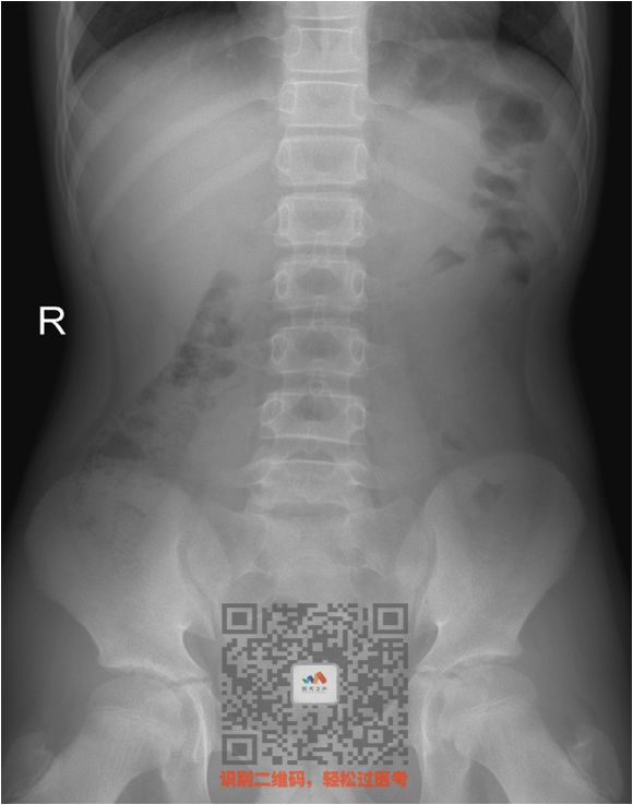 执医技能：X线阅片，全是套路，超简单