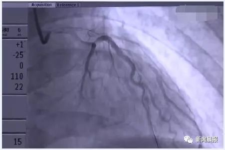 28岁小伙熬夜看球猝死,上海30岁年轻男子猝死