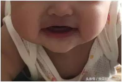 宝宝吐奶呈喷状是什么原因,宝宝吐奶呈喷射状