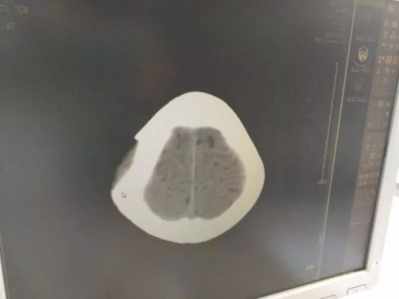 心痛7岁男童11楼坠亡,痛心10岁男孩从24楼跌落在住户家