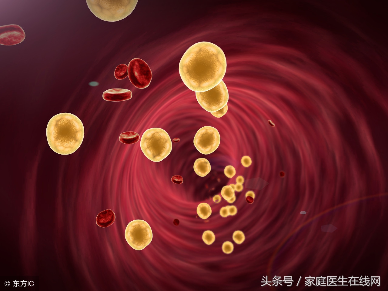 体检结果胆固醇高什么意思,血液胆固醇高危害