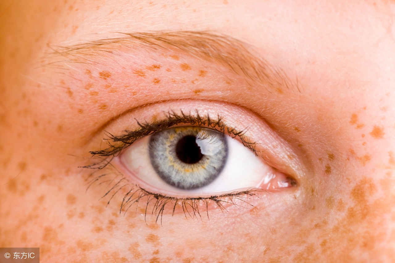 吃什么能消除色素沉着淡斑,除褐斑偏方