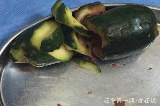 山东聊城一男子酒后摆弄瓜果，15厘米黄瓜滑入直肠，上演惊险一幕