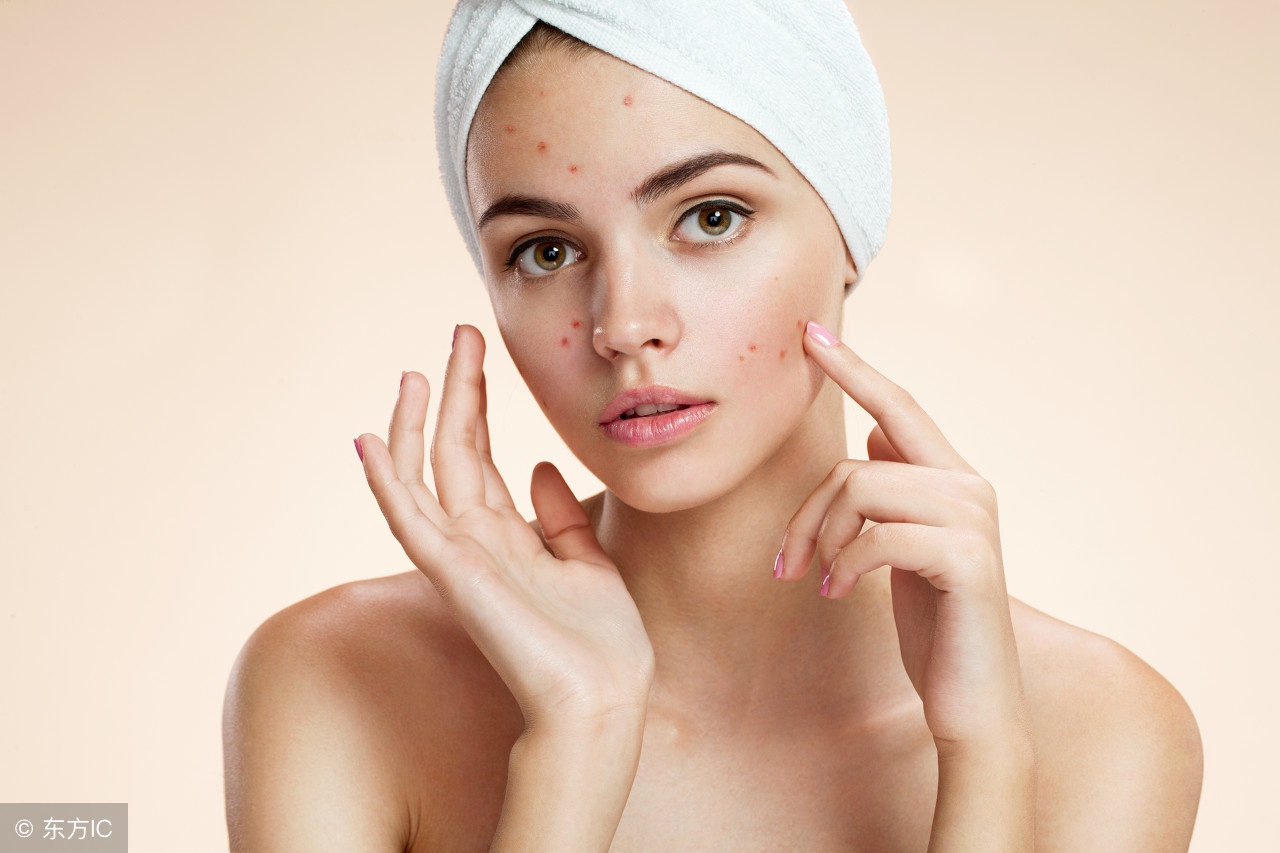 脸上长斑吃什么调理祛斑,脸上长斑吃什么中药调理