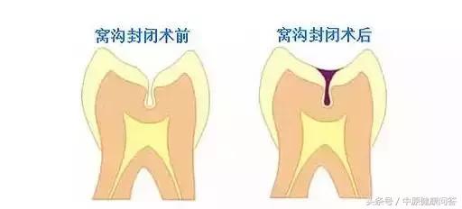 一女子吃杨梅,女子吃一斤樱桃后生命垂危