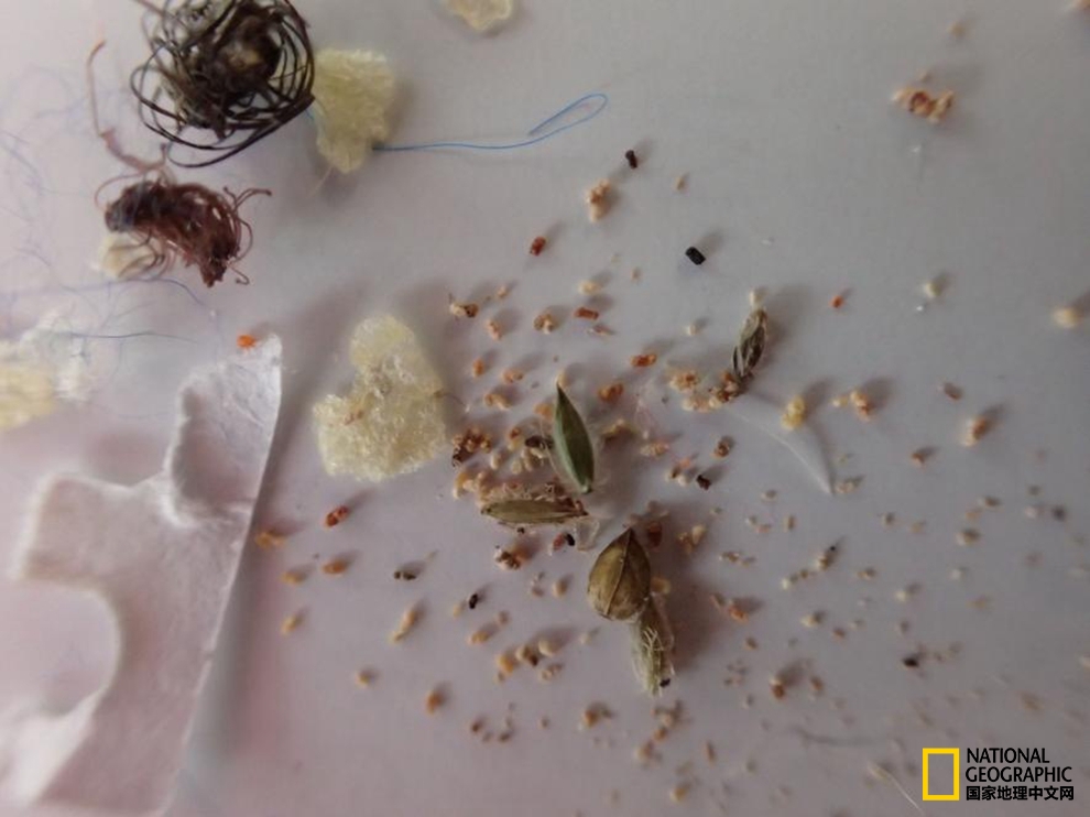 为啥人身体里有虫,总觉得自己体内有虫