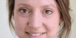 30岁眼角笑起来有皱纹,眼角笑起来有皱纹是老了吗