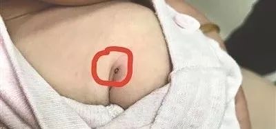 驱蚊止痒一招搞定,用什么驱蚊止痒效果最好