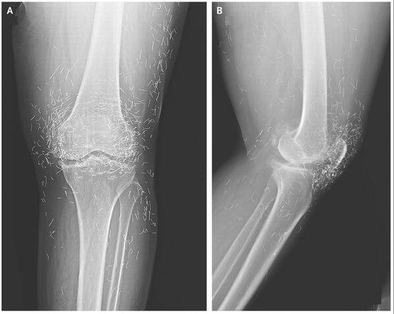 阴茎纹身还有这用处？医生应该见识的22个奇葩病例