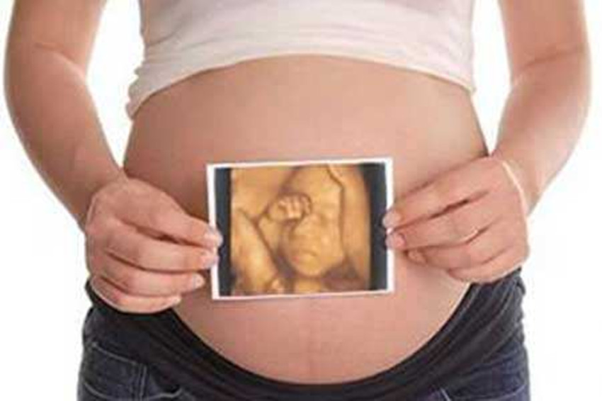 做四维彩超前，准妈妈应该做些什么准备，才能让检查顺利呢