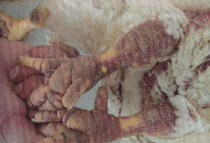 鹌鹑禽流感解剖图,鸡患禽流感症状及图片