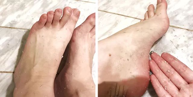 擦掉一张皮，双脚换皮术！死皮、老茧一喷就没，15秒还原嫩白玉足！