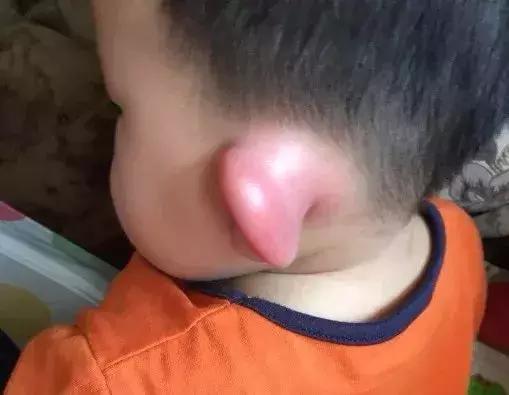 宝宝青草膏抑菌膏,止痒膏第一名青草膏