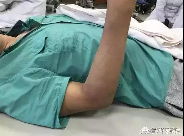 世界杯球员受伤,世界杯运动员损伤情况