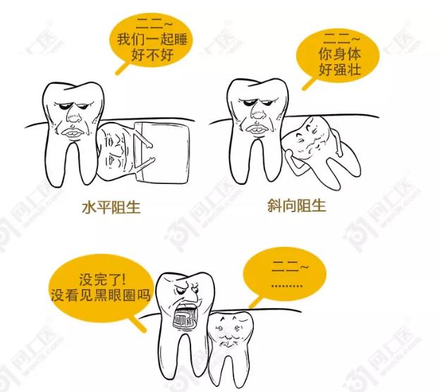 智齿为啥叫恒牙,智齿为什么叫阻生