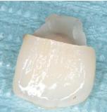 怎么拯救牙齿最快最有效,如何拯救牙齿