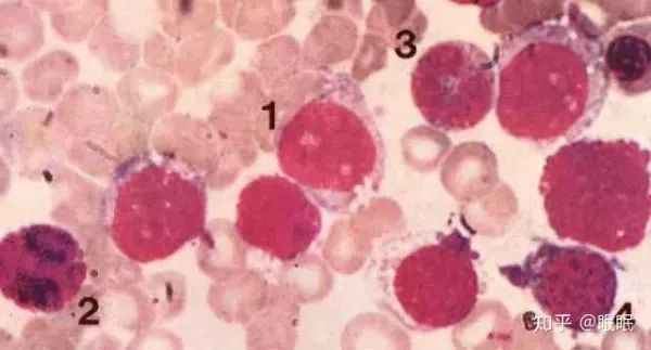 印度白血病新药,印度仿制白血病特效药