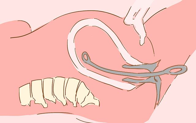 不小心流产了之后怎么办,不小心流产了怎么处理