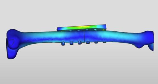 丹麦中场受伤视频,丹麦球员怎么受伤的欧洲杯