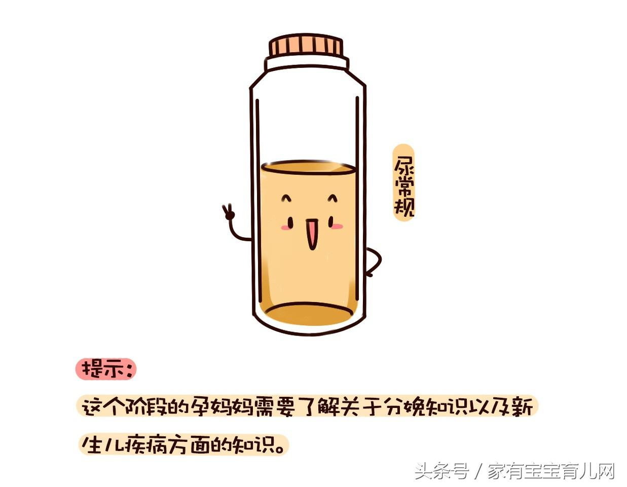 最全的产检时间表和项目唐氏,产检唐筛检查流程