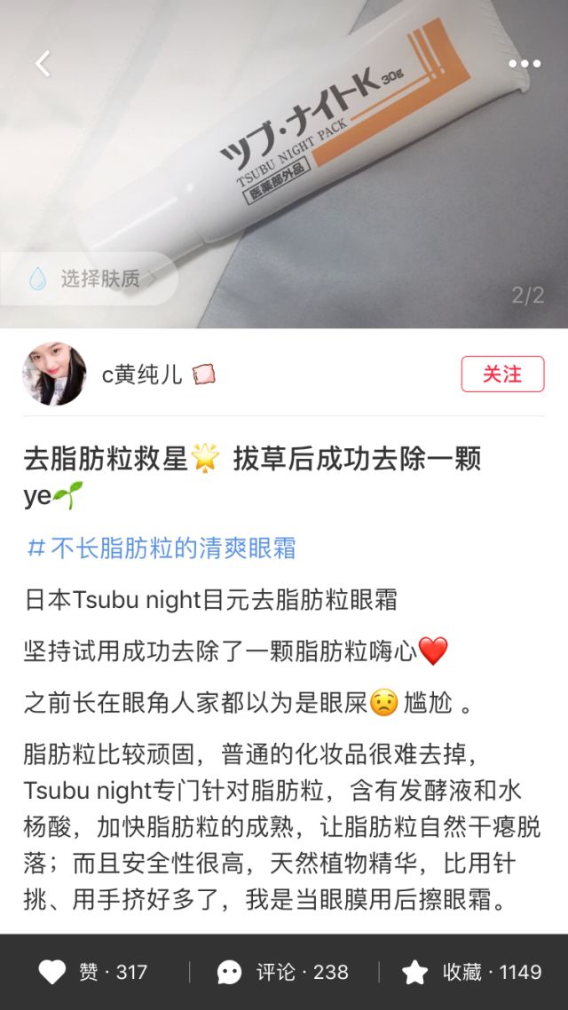 不用针挑手指扎进刺了怎么办,不用针挑就能挑出刺的方法