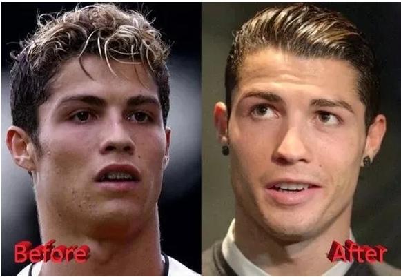 c罗整容过么,c罗整容了没