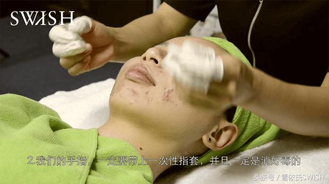 美容院排痘痘的方法,美容店祛痘痘的手法
