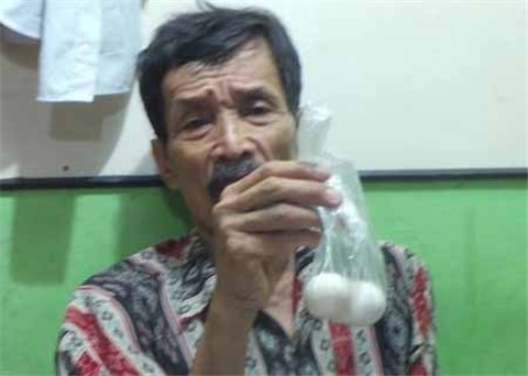 能下蛋的男人:印尼一男子竟每三月产蛋一次