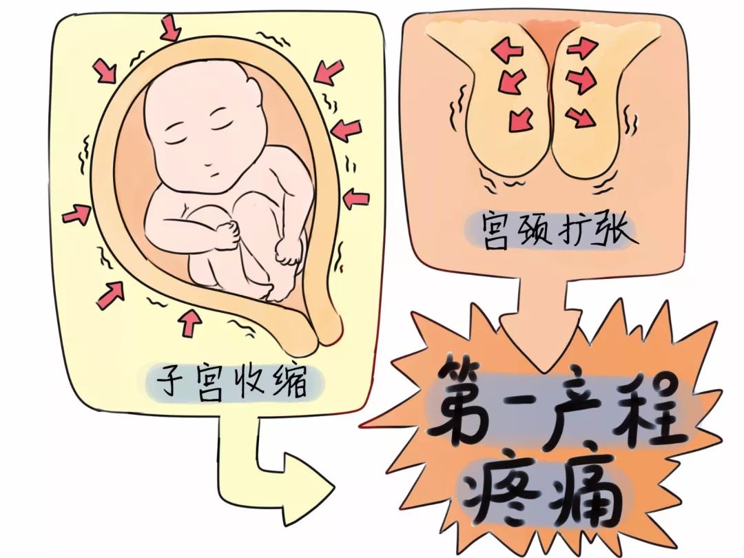 分娩阵痛大揭秘,分娩镇痛大揭秘生娃到底有多痛