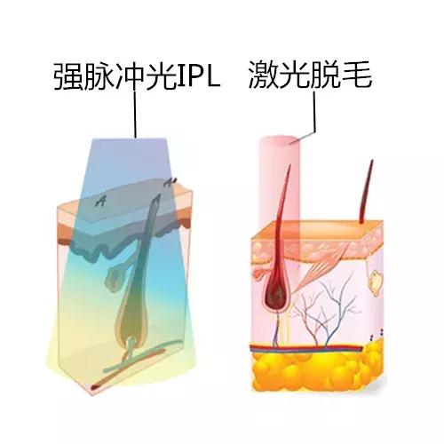 脱毛神器有哪些平价的好用,比较推荐的脱毛神器有哪些