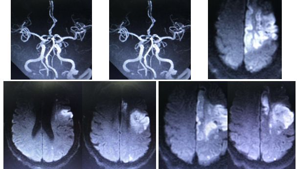 心血管内科急救流程,急诊静脉用药方法