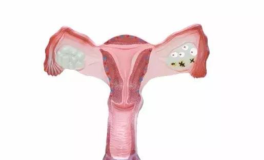 取卵子对身体有什么伤害？做好4点避免危险发生