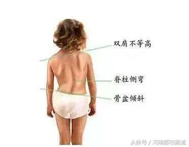 19岁女孩拍x光医生一句话引热议,3岁照x光