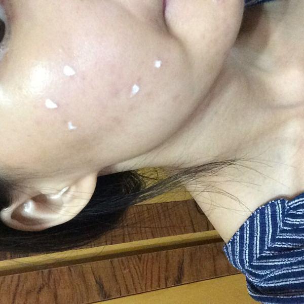 干货|低成本治烂脸攻略:两周见效消闭口淡痘印小经验