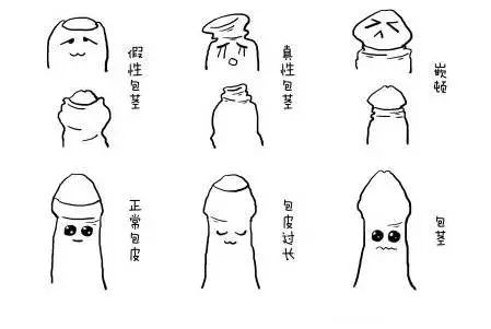 如何自测包皮要不要割,包皮真假的辨别